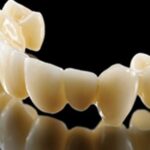 ORIZIN ROYAL (NEZZXR t LAYERED LIFE TIME WARRANTY)