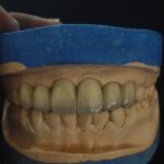 IPS ZIRCAD PRIME ORIZIN
