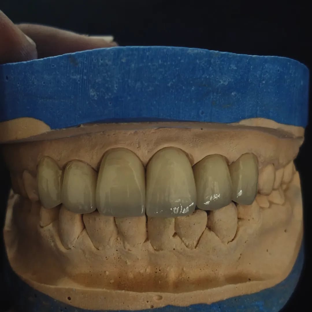 IPS ZIRCAD PRIME ORIZIN