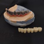 DMLS TITANUIM PALO MALO BAR WITH ZIRCONIA