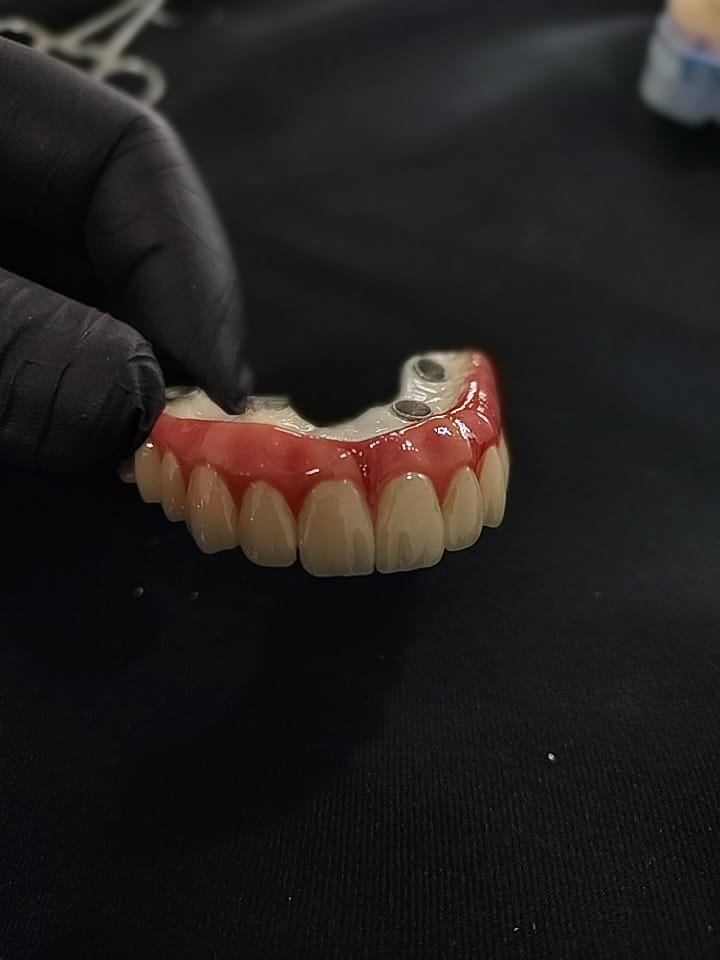 DMLS CO-CR BREDENT HIPC HYBRID DENTURE
