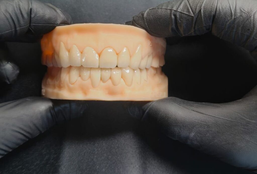 ORIZIN STANDRAD CROWNS (NEXXZR t ZIRCONIA)