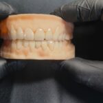 ORIZIN STANDRAD CROWNS (NEXXZR t ZIRCONIA)